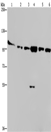 Western Blot analysis of Human testis tissue, K562, A549, Raji, NIH/3T3 and Hela cell using PRKD3 Polyclonal Antibody at dilution of 1:200