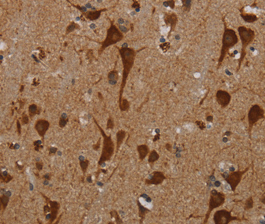 Immunohistochemistry of paraffin-embedded Human brain tissue using KMT2D Polyclonal Antibody at dilution 1:40