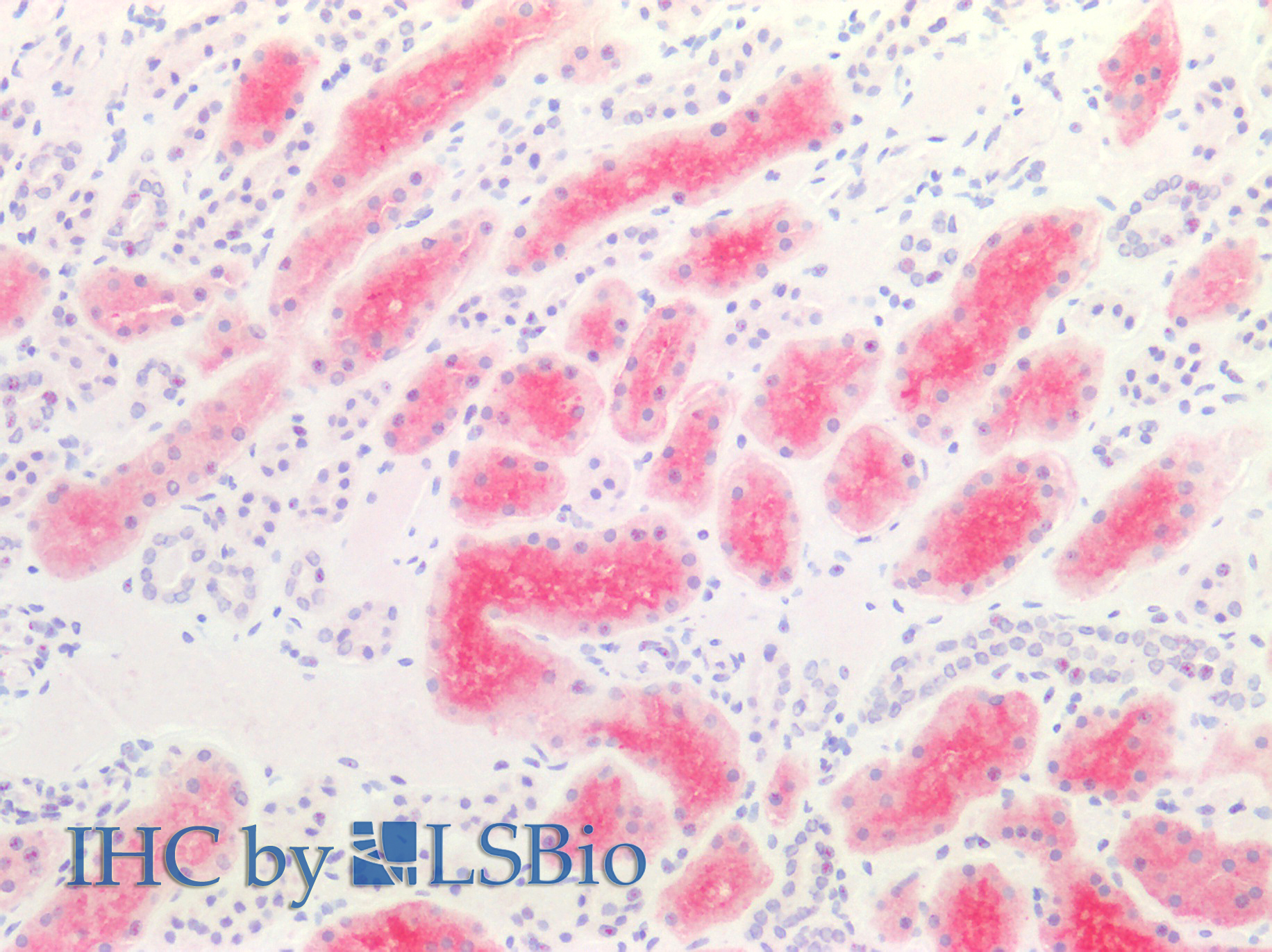 Immunohistochemistry of paraffin-embedded Human kidney tissue using CD10 Polyclonal Antibody at dilution of 1:100.