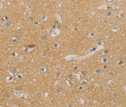 Immunohistochemistry of paraffin-embedded Human brain using NDRG1 Polyclonal Antibody at dilution of 1:70