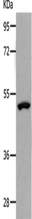 Western Blot analysis of Human lymphoma tissue using NDRG1 Polyclonal Antibody at dilution of 1:1000