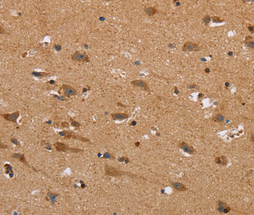 Immunohistochemistry of paraffin-embedded Human brain tissue using NDRG3 Polyclonal Antibody at dilution 1:40