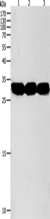 Western Blot analysis of Mouse liver and kidney tissue, RAW264.7 cell using NIT2 Polyclonal Antibody at dilution of 1:950