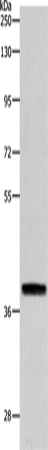 Western Blot analysis of RAW264.7 cell using RTN4 Polyclonal Antibody at dilution of 1:900