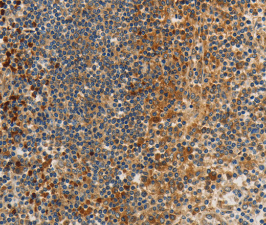 Immunohistochemistry of paraffin-embedded Human tonsil tissue using PPP2CB Polyclonal Antibody at dilution 1:80