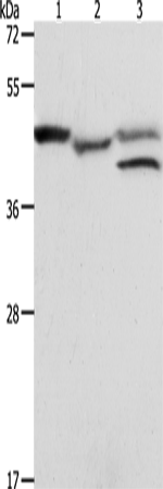 Western Blot analysis of K562 cell and Mouse heart tissue, MCF7 cell using PSMD6 Polyclonal Antibody at dilution of 1:900