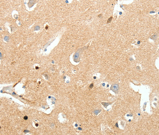 Immunohistochemistry of paraffin-embedded Human brain tissue using SCN9A Polyclonal Antibody at dilution 1:40