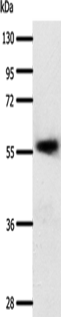 Western Blot analysis of Human esophagus cancer tissue using SLC22A17 Polyclonal Antibody at dilution of 1:600