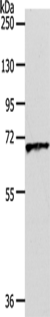 Western Blot analysis of Human liver cancer tissue using Oct-3 Polyclonal Antibody at dilution of 1:600