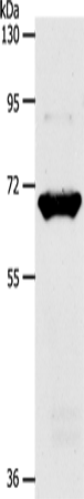 Western Blot analysis of Mouse liver tissue using SLC33A1 Polyclonal Antibody at dilution of 1:1100