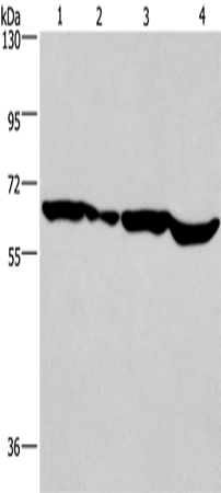 Western Blot analysis of Hela cell and Mouse heart,K562 and Jurkat cell using SOX-18 Polyclonal Antibody at dilution of 1:650