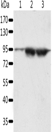 Western Blot analysis of A549 and lncap cell, Human seminoma tissue using SPATA20 Polyclonal Antibody at dilution of 1:1000