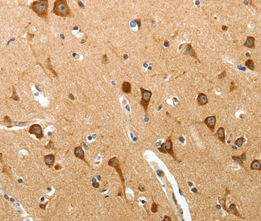 Immunohistochemistry of paraffin-embedded Human brain tissue using BIRC6 Polyclonal Antibody at dilution 1:40