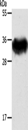 Western Blot analysis of Mouse brain tissue using STX1A Polyclonal Antibody at dilution of 1:600