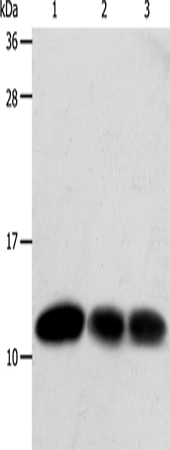 Western Blot analysis of Hela and MCF7 cell, Human liver cancer tissue using TXN Polyclonal Antibody at dilution of 1:600