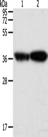 Western Blot analysis of Human leiomyosarcoma and Mouse testis tissue using TPM2 Polyclonal Antibody at dilution of 1:1000