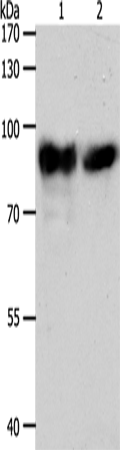 Western Blot analysis of Mouse heart tissue and hela cell using ACO2 Polyclonal Antibody at dilution of 1:400