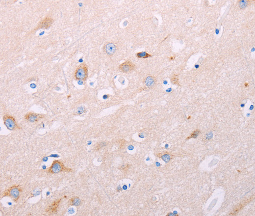 Immunohistochemistry of paraffin-embedded Human brain tissue using ADCY5 Polyclonal Antibody at dilution 1:40