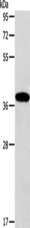 Western Blot analysis of Human fetal liver tissue using ALDOB Polyclonal Antibody at dilution of 1:260