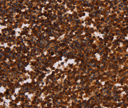 Immunohistochemistry of paraffin-embedded Human tonsil tissue using ALG11 Polyclonal Antibody at dilution 1:40