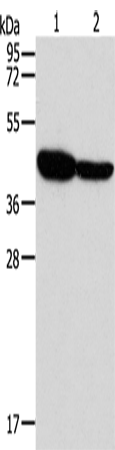 Western Blot analysis of Mouse brain and Human fetal brain tissue using GLRA1 Polyclonal Antibody at dilution of 1:500