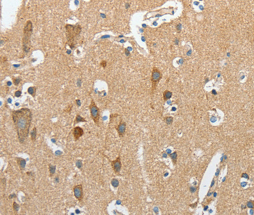 Immunohistochemistry of paraffin-embedded Human brain  using DSCR1 Polyclonal Antibody at dilution of 1:45