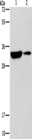 Western Blot analysis of Mouse heart and brain tissue using DSCR1 Polyclonal Antibody at dilution of 1:500