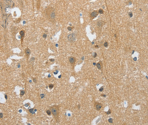 Immunohistochemistry of paraffin-embedded Human brain  tissue using PITX3 Polyclonal Antibody at dilution 1:40