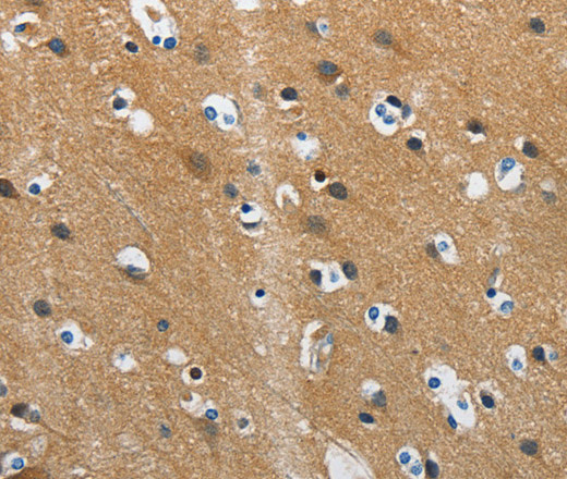 Immunohistochemistry of paraffin-embedded Human brain  tissue using DDAH1 Polyclonal Antibody at dilution 1:55