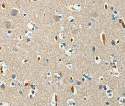 Immunohistochemistry of paraffin-embedded Human brain  using SERPINA9 Polyclonal Antibody at dilution of 1:60