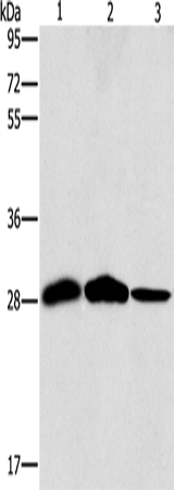 Western Blot analysis of Mouse liver and Human chromaffin cell tumor tissue, hepG2 cell using SPR Polyclonal Antibody at dilution of 1:1500