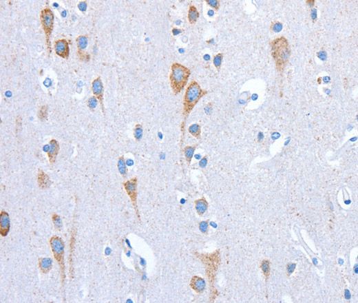 Immunohistochemistry of paraffin-embedded Human brain tissue using CD133 Polyclonal Antibody at dilution 1:70