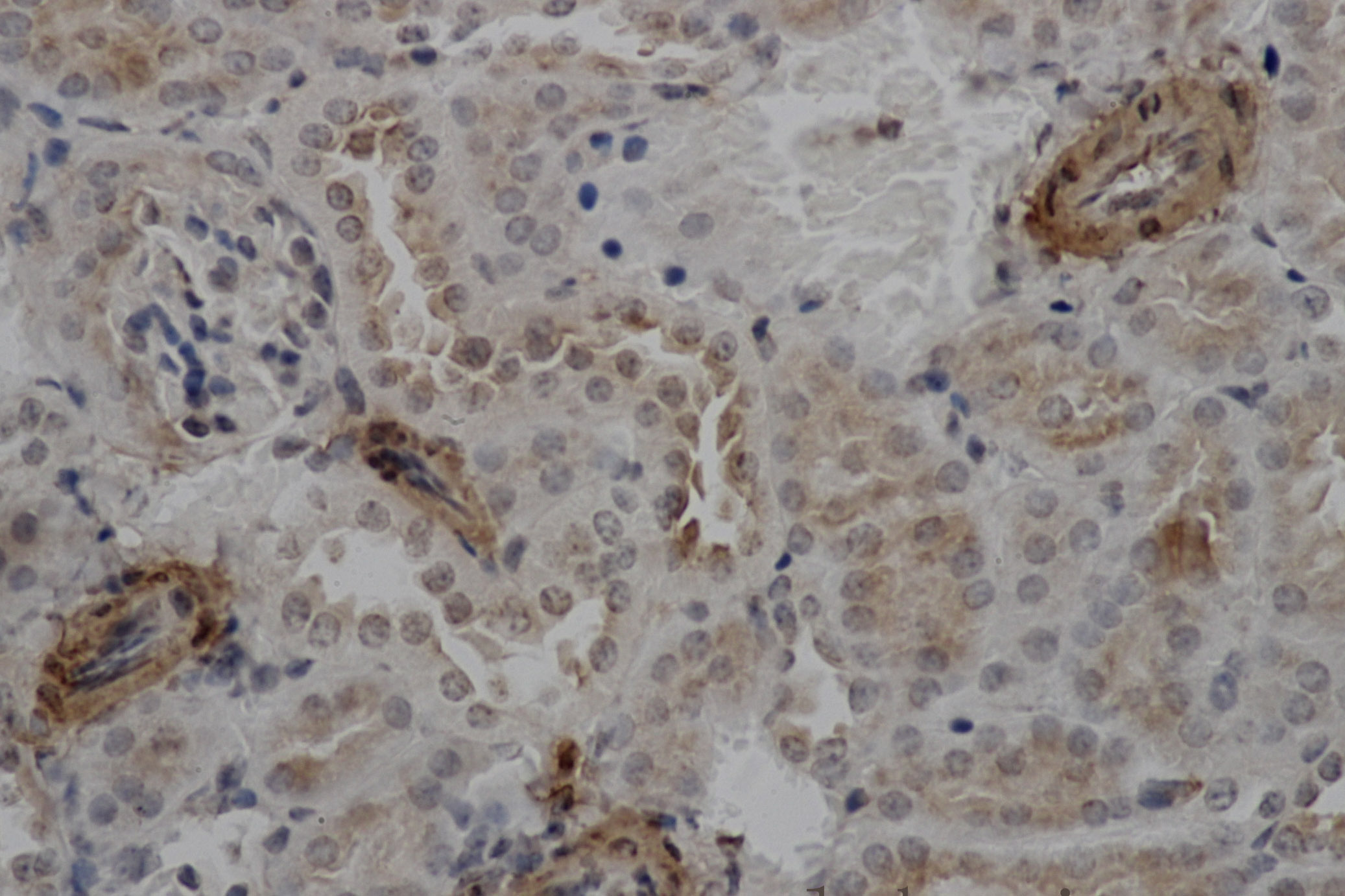 Immunohistochemistry of paraffin-embedded Mouse kidney using ACTA2 Polyclonal Antibody at dilution of 1:50