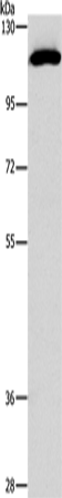 Western Blot analysis of PC3 cell using STAT2 Polyclonal Antibody at dilution of 1:800