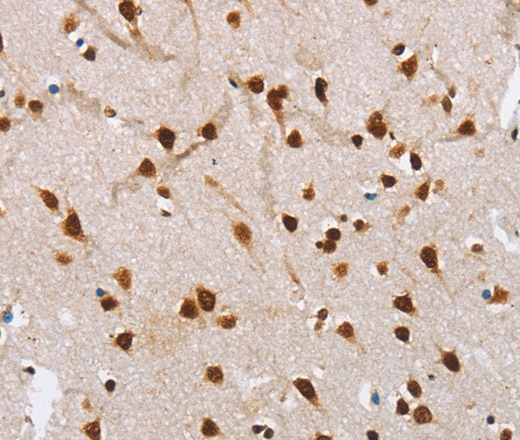 Immunohistochemistry of paraffin-embedded Human brain  tissue using NLRP7 Polyclonal Antibody at dilution 1:60