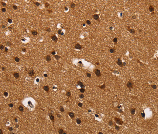 Immunohistochemistry of paraffin-embedded Human brain  tissue using ARSB Polyclonal Antibody at dilution 1:50