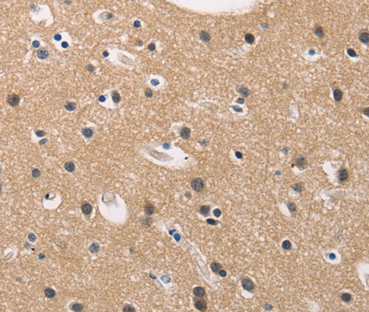 Immunohistochemistry of paraffin-embedded Human brain tissue using ADGRB1 Polyclonal Antibody at dilution 1:40