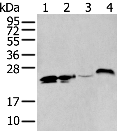 Western Blot analysis of Mouse spleen tissue using BCAS4 Polyclonal Antibody at dilution of 1:1200