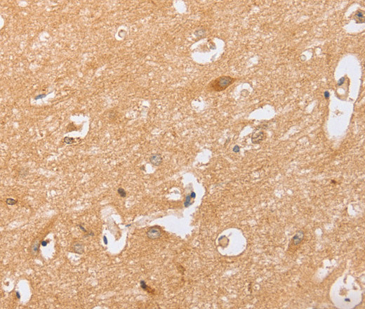 Immunohistochemistry of paraffin-embedded Human brain  tissue using BST1 Polyclonal Antibody at dilution 1:40