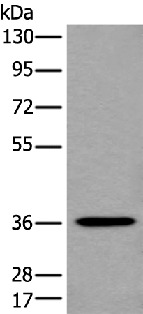 Western Blot analysis of Mouse kidney tissue using NCR1 Polyclonal Antibody at dilution of 1:450