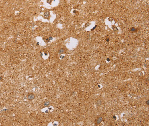 Immunohistochemistry of paraffin-embedded Human brain  using CD38 Polyclonal Antibody at dilution of 1:60