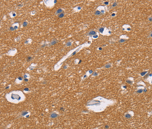 Immunohistochemistry of paraffin-embedded Human brain tissue using CD47 Polyclonal Antibody at dilution 1:50