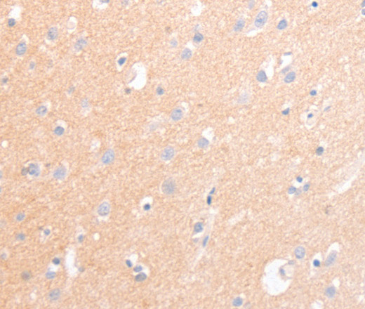 Immunohistochemistry of paraffin-embedded Human brain tissue using CD56 Polyclonal Antibody at dilution 1:30