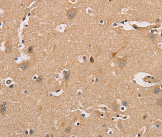 Immunohistochemistry of paraffin-embedded Human brain tissue using CDK11A/B Polyclonal Antibody at dilution 1:50