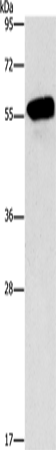 Western Blot analysis of Mouse eyes tissue using CDK19 Polyclonal Antibody at dilution of 1:950