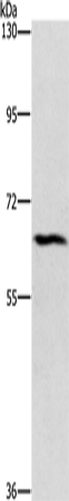 Western Blot analysis of Hela cell using CERKL Polyclonal Antibody at dilution of 1:1100