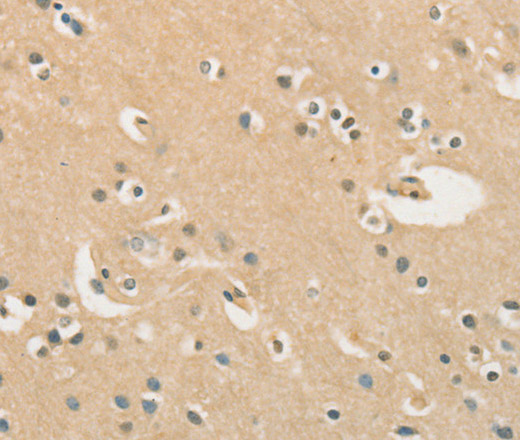 Immunohistochemistry of paraffin-embedded Human brain  using CHRNA2 Polyclonal Antibody at dilution of 1:40