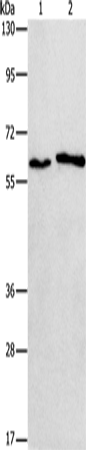 Western Blot analysis of A172 and A549 cell using CHRNA2 Polyclonal Antibody at dilution of 1:950