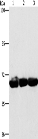 Western Blot analysis of 293T, hepG2 and A549 cell using CKAP4 Polyclonal Antibody at dilution of 1:750