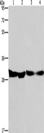 Western Blot analysis of Human endometrial carcinoma and colon cancer tissue, Mouse heart tissue and PC3 cell using DECR1 Polyclonal Antibody at dilution of 1:300